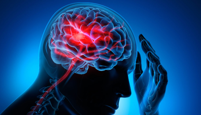 How to prevent a stroke