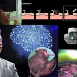 Neuralink : Human Trials are Coming
